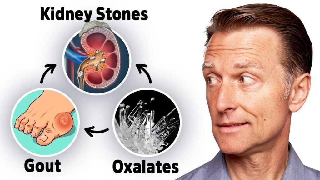 the-connection-between-oxalates-gout-and-kidney-stones-gadico